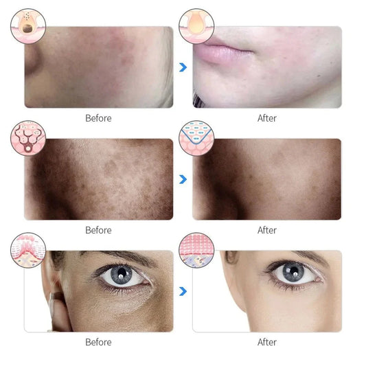 GlowRevive LED Light Therapy Face Mask